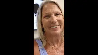 Full mouth dental implants with Zirconium hybrid prosthesis for Kathy at Marietta Dental