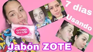 7 d&iacute;as usando jab&oacute;n ZOTE en mi rostro 😱 &iquest;como fueron los resultados? -Anayellin Sosa💖