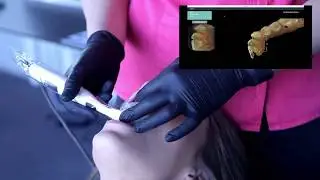 Condor Intra Oral Scanner - Scan Demo