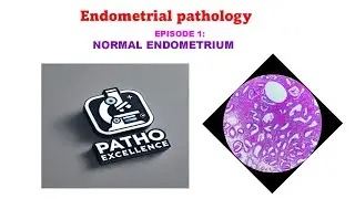 Silent Focus Learning: Endometrium Basics | No Music | EP1