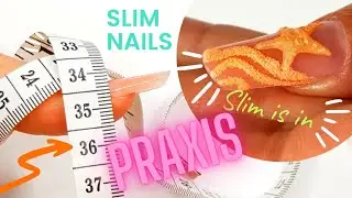 SLIM NAILS PRAXIS: Hübscher als gedacht?