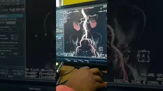 ct urogram done by fujifilm ct-scan