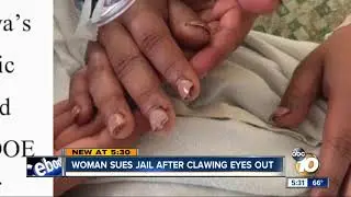 Woman sues jail after clawing out eyes