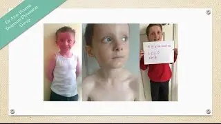 Eczema Transformations: healed by Dr Aron