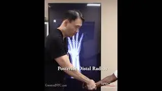 Thumb & Wrist Pain GONE! De Quervain&rsquo;s Fixed Without Surgery #dequervains