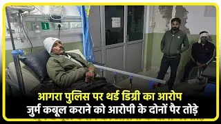 Agra Police Torture Case: जुर्म कबूल कराने के लिए युवक को थर्ड डिग्री, दोनों पैर टूटे