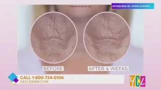 Firmer, Younger-Looking Neck and Chest at Any Age | Sponsored