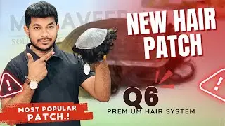 Q6 Hair Patch Unboxing | Natural Look & Frontline, Best Hair Patch for Men? #india #newpatch