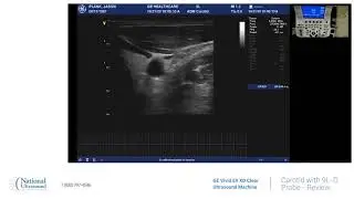 GE Vivid E9 XD Clear Carotid Ultrasound Training Video with 9L D probe