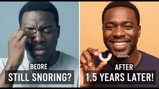 SnoreRx Plus Review: 1.5 Years Later (The Brutal Truth About My Snoring & Sleep Apnea)