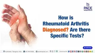 How is Rheumatoid Arthritis Diagnosed? | Medical Test for Rheumatoid Arthritis #RheumatoidArthritis