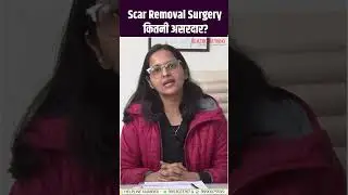 Scar Removal Surgery कितनी कारगर है? सच जानिए | Dr Preeti Yadav | Scar Treatment Results