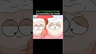 The #1 Mistake You're Making With Your Teeth( And Why Food Gets Stuck)