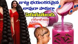 “ఈ Secret Onion Coconut Oil Mix మీరు నమ్మి వాడితే పక్కా Result💯 7 రోజుల్లోనే Nonstop Hair Growth 🌿🔥”