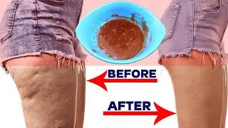 This mixture for weight loss | Nature Cure Fit
