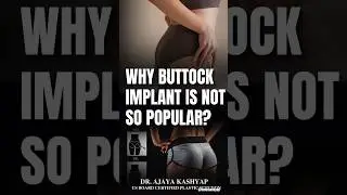 Why Buttock Implant Is Not So Popular? | Buttock Implant vs BBL  #buttimplant #short