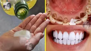Dentisti ma tregoi kete sekret: Ja si te pastroni gurzat sa hap e mbyll syte me keta perberes