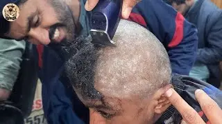 Бездомный мальчик 😳 Самые твердые прыщи Перхоть Удаление волос на голове Урок по бритью головы дл...