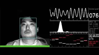 Application of the implemented real-time rPPG signal processing for driver monitoring