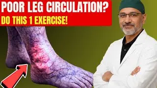 Surgeon REVEALS: Do THIS 1 Exercise for Poor Leg Circulation After 60 | Senior Health.