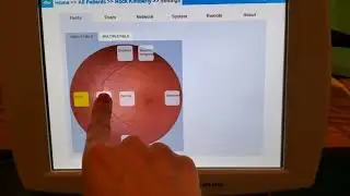 Vision Professionals DRS Fundus Camera