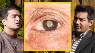 SAVE YOUR EYES Before It's Late - Cataract In Young People Explained
