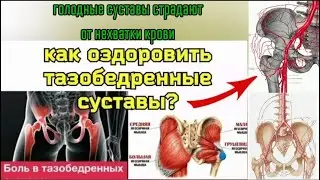Зажим подвздошной артерии вредит тазобедренным суставам и половым органам. Методы декомпрессии