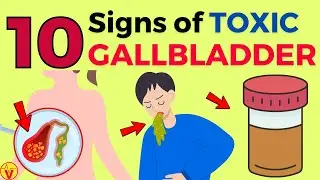 10 WARNING Signs That Your GALLBLADDER Is Full of Toxins | Gallstones Symptoms | VisitJoy