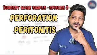 Approach to Perforation Peritonitis | Must-Know Surgery Topic for NEET PG