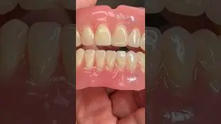 Detailed Immediate Denture for Dr. Mouhannad Almajdal in California