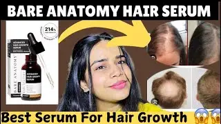 Bare Anatomy Hair Growth Serum Review I Bare Anatomy Advanced Hair Growth Serum IReview 2024