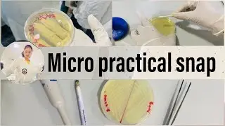 Micro Practical Snap |  Evaluation of Antimicrobial Activity 🦠🧪