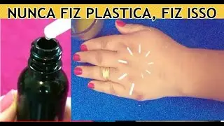 REMOVE Toda PELE VELHA das M&Atilde;OS e BRA&Ccedil;OS - SUGA RUGAS, MANCHAS e REMO&Ccedil;A
