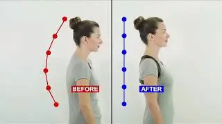 Posture Doctor