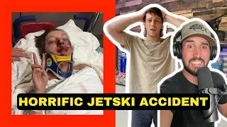 Nearly Fatal Jetski accident.. Hospital & Surgery required.. (Jiggin & Yappy) *BANGER PODCAST*