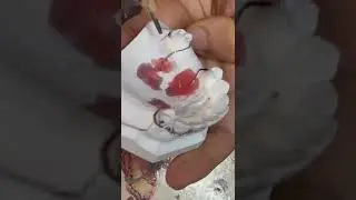 رسم دزاين partial denture المرحلة الثالثة