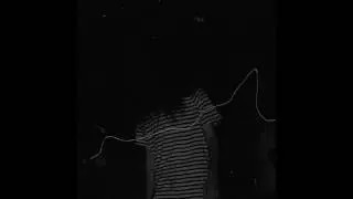 13. Bones - MossOnBrick (Bonus) (Produced by Greaf)