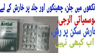 Antial Tablets Loratadine || How to use Antial tablets loratadine 10mg || Mr. Khalil Ahmad Shagird||