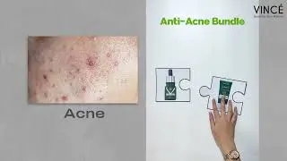Best Skincare Combos for Every Skin Concern | Perfect Pairs for Glowing Skin ✨