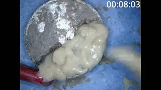 Cleaning a dirty coin found metal detecting : Chemical vs Mechanical Method |