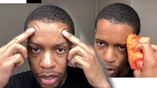 How to get rid of the line on your forehead from the Durag! ( how to get waves