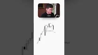 Вы никогда не станете прибыльным трейдером золота, пока не поймете этого.