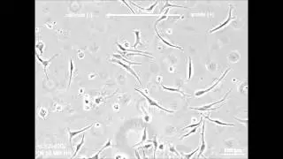 Cellular microenvironment modulates the galvanotaxis of brain tumor initiating cells
