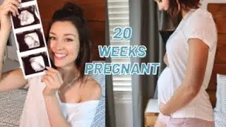 20 WEEK SCAN | 3D PHOTOS | OH BABY BOXES