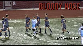 Out of the Box Goal *Parker Cup* Bishop's vs High Tech SD Boys Soccer