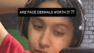 Are face dermals worth it ??