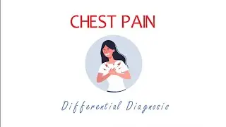 CHEST PAIN || History Taking & Differential Diagnosis  #medicine #doctor  #plab1  #plab2
