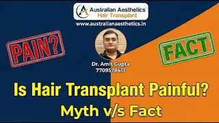 Is Hair Transplant Painful Myth vs Fact 2