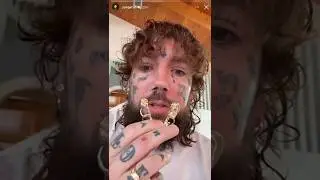 Scrim shows his new back molars and talks about his dentist chart. Picture of chart at end of vid
