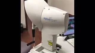 VISX Wavescan Tutorial - RRFR Eye Associates